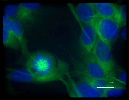 picture CHLA90 cell line picture CHLA90 cell line